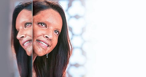 Deepika Padukone in 'Chhapaak'