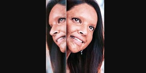 Deepika Padukone in 'Chhapaak'