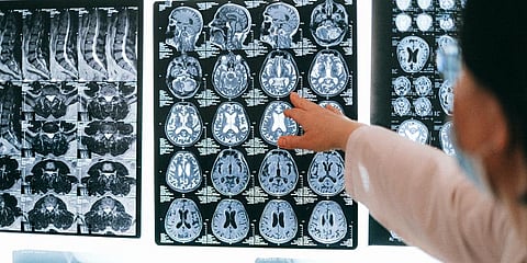 For representational purposes. (Photo | Pexels)