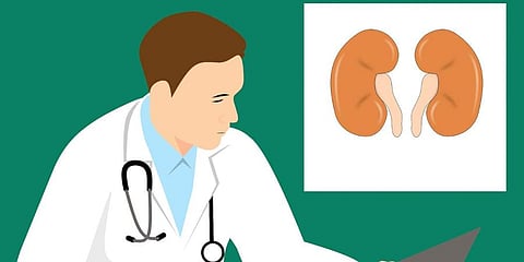 For representational purposes