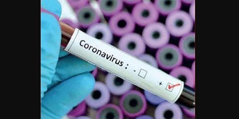 For representational purposes