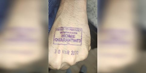 The left hand of all persons shunted to 100 per cent home quarantine have been stamped to identify them easily if they mingle with the general public.