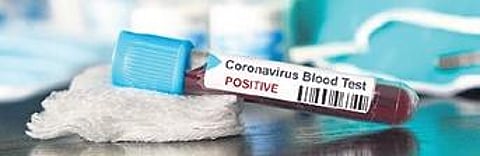 NIRDPR, UNICEF train over 28 lakh community leaders to fight Covid