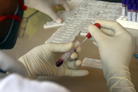 A medic works on a sample for COVID-19 rapid test center. (Photo | Biswanath Swain, EPS)
