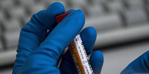 For representational purposes