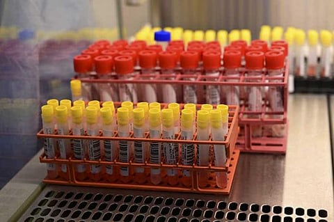 A picture taken on April 3, 2020 at the microbiology laboratory of the Circolo di Varese hospital shows samples of the novel coronavirus, amid the spread of the epidemic COVID-19. (Photo | AFP)