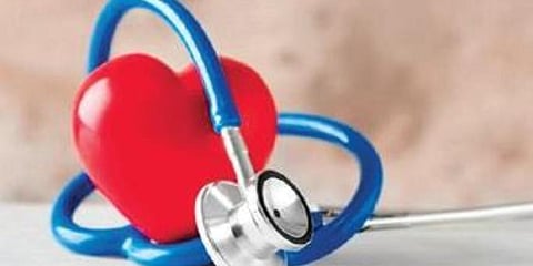 For representational purposes