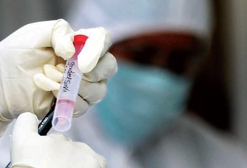 Plasma is a component of blood. The blood of people who have recovered from an infection contains antibodies.