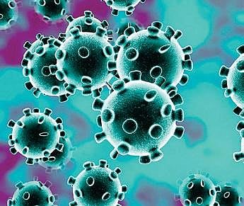 Representational image