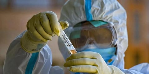 The Health Department attributed the spike to the enhanced testing capability. (File Photo | PTI)