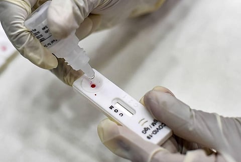 A health worker collects a sample of a Greater Chennai Corporation employee for COVID-19 via Rapid Antigen at Amma Malligai Auditorium in Chennai Thursday July 16 2020. (Photo | PTI)