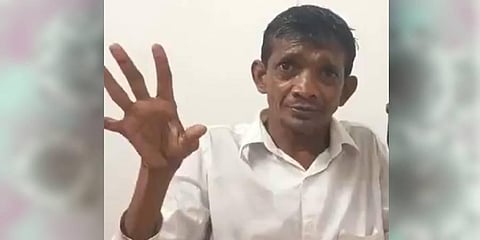 Karnataka Congress Councillor Ravichandra Gatti. (Photo | Twitter)