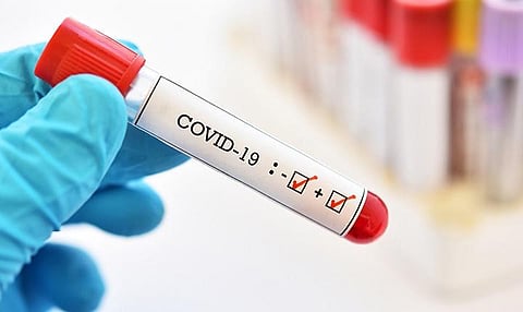 Kochi firm to manufacture Covid test kits