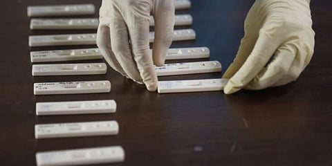 Swabs being tested at the lab at the Viral Research and Diagnostic Laboratory. (Photo | PTI)