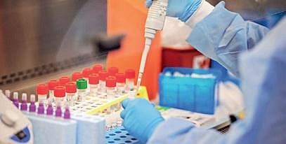 Image used for representational purpose only (File Photo)