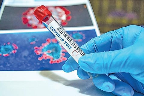 COVID-19 blood test sample.
