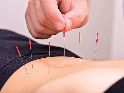 For representational purposes