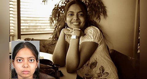 If one notices a recent bulging of the eye, or increase in fat-bags around the eye, it is a probable clue.