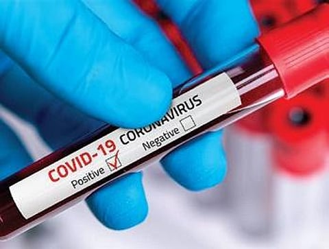 For representational purposes