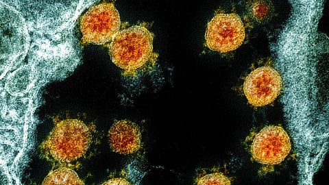 Image used for representational purposes only.