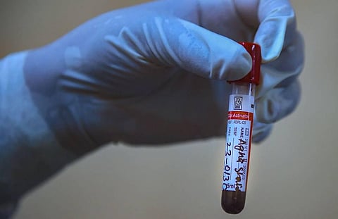 As many as 7,761 COVID-19 infected have been treated and discharged including 275 on Thursday. (File Photo | PTI)