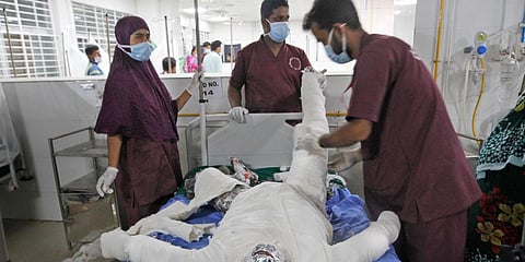 Doctors treat a burn Muslim worshipper in a hospital in Dhaka. (File photo| AP)