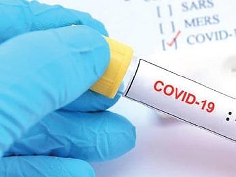 For representational purposes