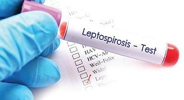 Image used for representational purposes only