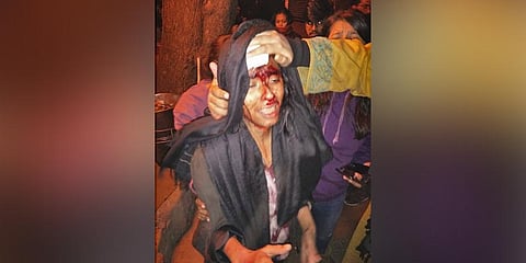 Jawaharlal Nehru University Student Union (JNUSU) President Aishe Ghosh attacked inside JNU campus by alleged ABVP members. (Photo | Twitter)