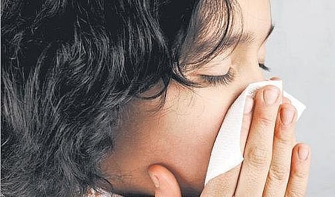 For representational purposes