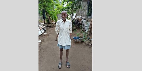 Who’s blind? Babus deny pension to armless man