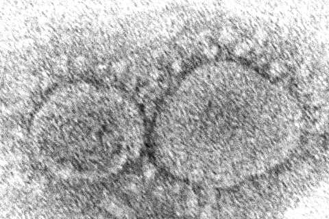 This 2020 electron microscope image made available by the Centers for Disease Control and Prevention shows SARS-CoV-2 virus particles which cause COVID-19. (Photo | AP)