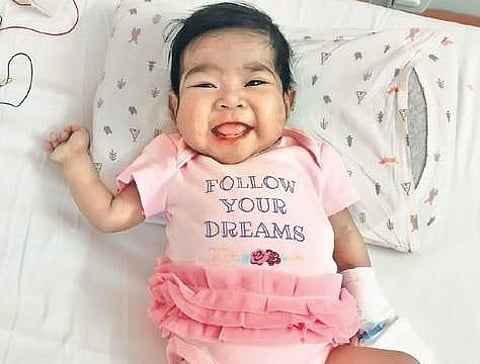 Baby Grace post the surgery. (Photo | EPS)