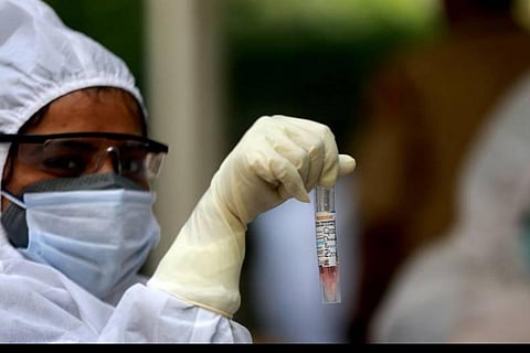 Image for representation (File | EPS/Shekhar Yadav)