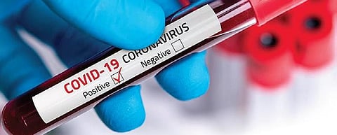 Image used for representational purposes