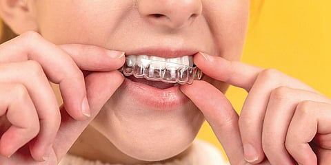 For representational purposes