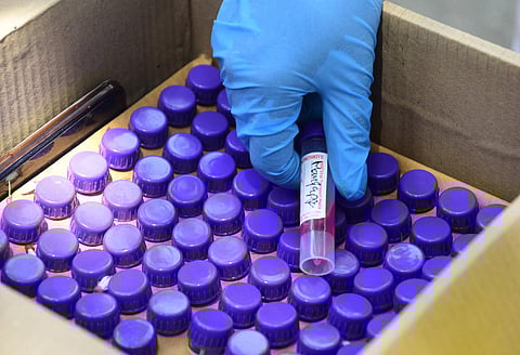 A medical worker arranges swab sample during the COVID-19 test. (Photo | Ashishkrishna HP, EPS)