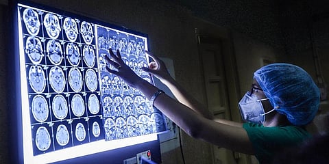 Doctors perform a Diagnostic Nasal Endoscopy (DNE) on a patient to detect Black Fungus at NSCB medical college and hospital in Jabalpur. (Photo | PTI)