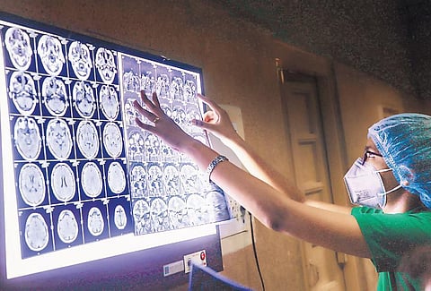 Steroid treatment can cause white fungal infection in Covid patients while unsterile use of oxygen cylinders can also be a reason. (Photo| PTI)