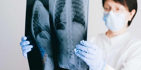 Representative Image.