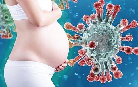 For representational purposes