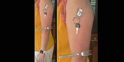 Jyothi Gowda took her first dose of Covaxin on April 26 and the second on May 29.