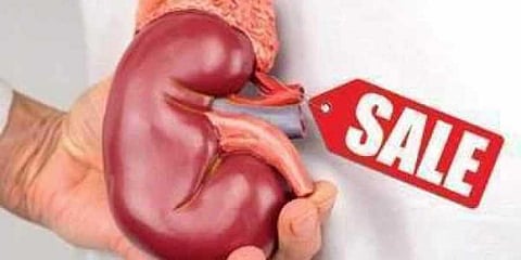 For representational purposes