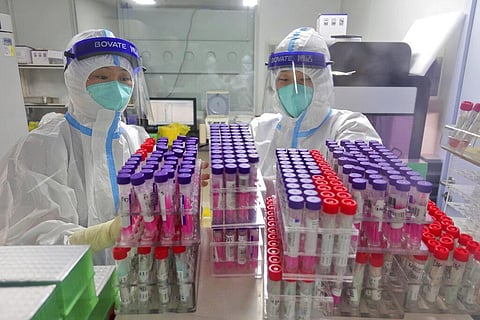 Workers handle swab samples for COVID-19 test at a hospital lab in Yantai in eastern China's Shandong province on Aug. 7, 2021. (Photo | AP)