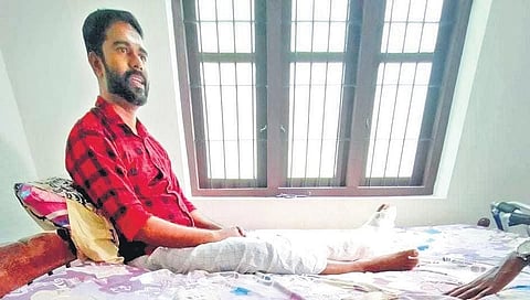 Kozhikode plane crash: Shareef still living with pain, says life will never be the same again
