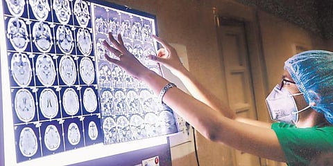 The study is presently uploaded in Medrxiv and is not yet peer reviewed. (Photo | PTI)