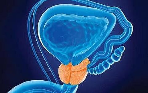 Laser surgery for enlarged prostate