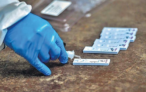 RT-PCR detects the viral genetic material (RNA) and is quite accurate. (File Photo)