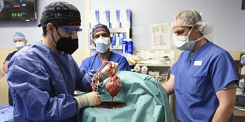 In this photo provided by the University of Maryland School of Medicine, members of the surgical team show the pig heart for transplant into patient David Bennett in Baltimore (Photo | AP)