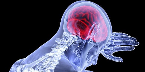 For representational purposes